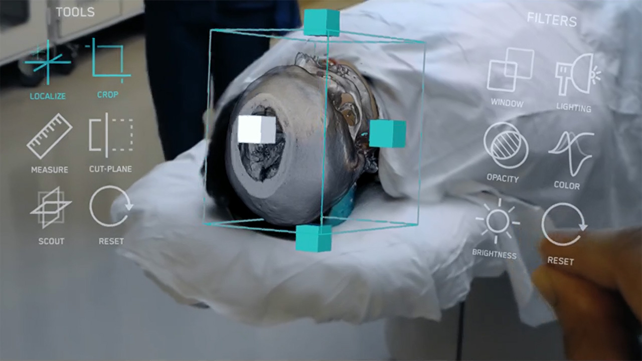 Medivis Watch our new campaign about how the computing power of Verizon 5G Ultra Wideband will help give doctors access to the level of surgical precision they need.