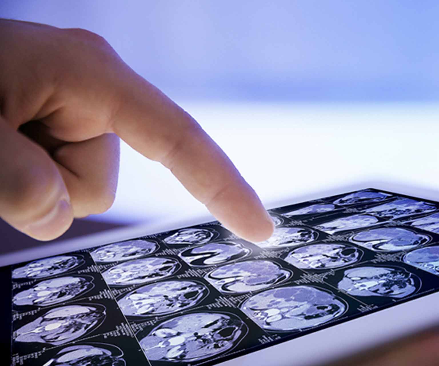Medical Device Company Solutions Success Story