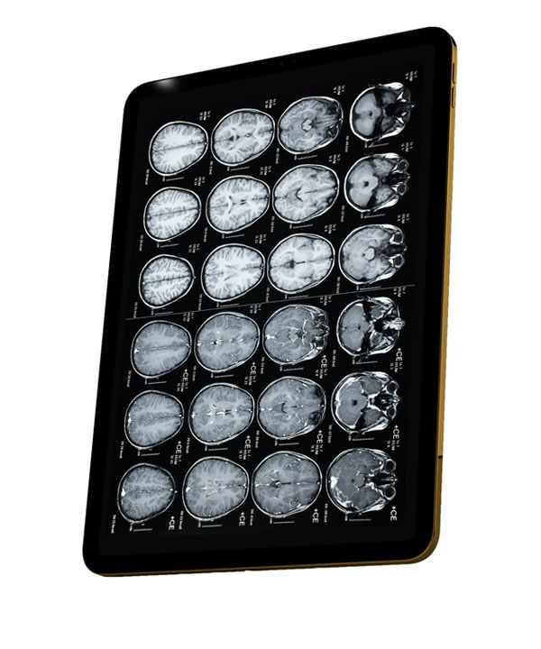 Tablet showing MRI results.