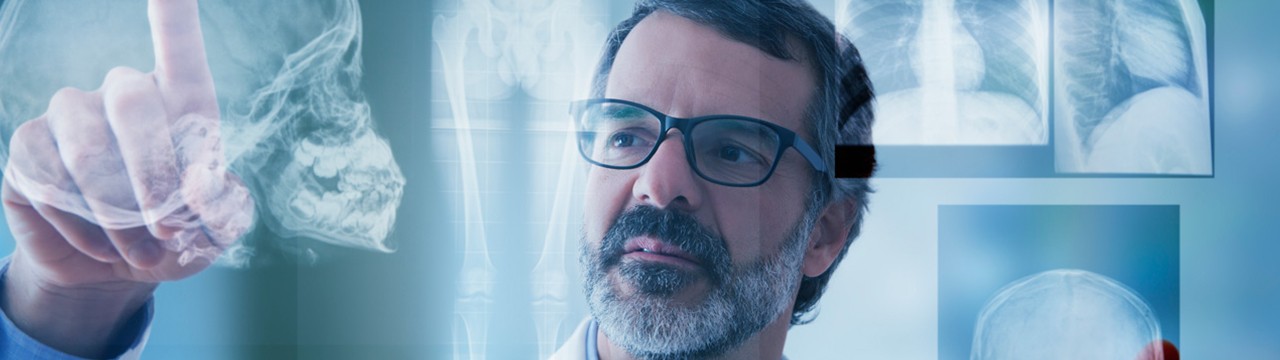 A man pointing to a head x-ray image.