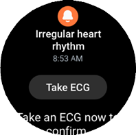 Galaxy Watch ECG screenshot