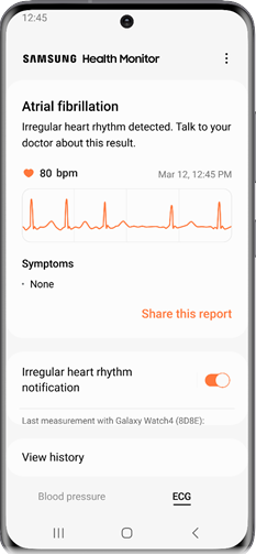 Galaxy Watch Irregular Heart Rhythm Notification screenshot